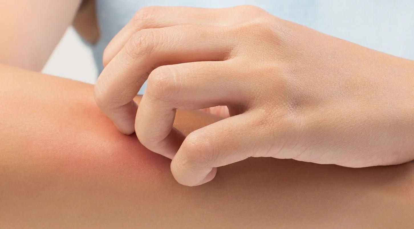 Menjaga Kenyamanan Kulit melalui Lingkungan Sehari-hari